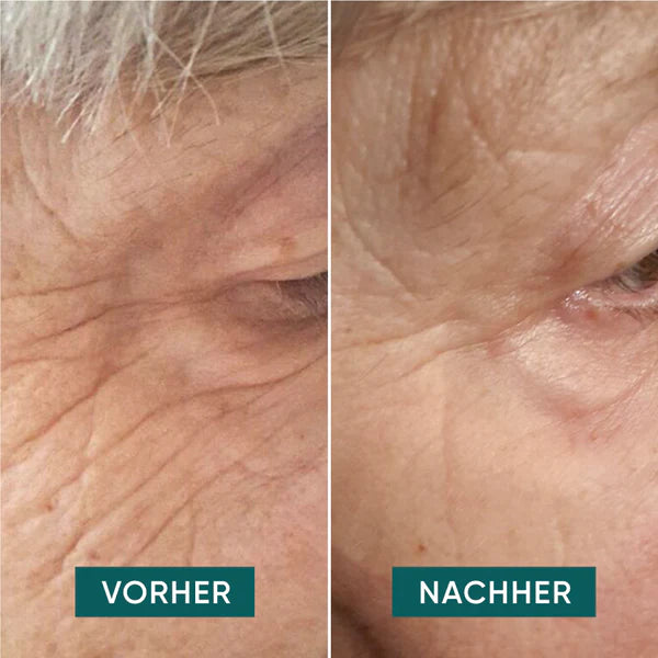 Apricot Beauty - Eye & Temple Pads Hyaluron (Eye love it)