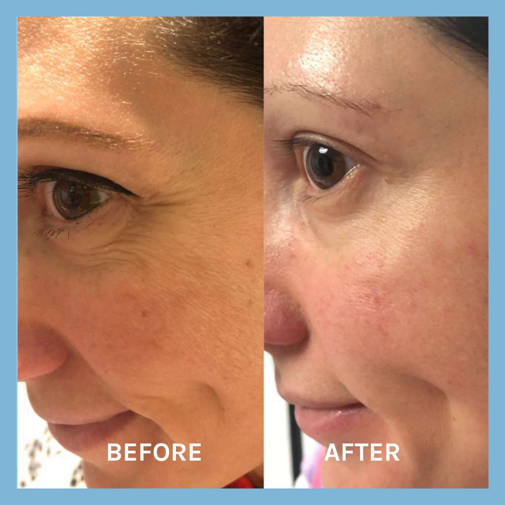Evolve - Age defying Lifting Serum 30ml